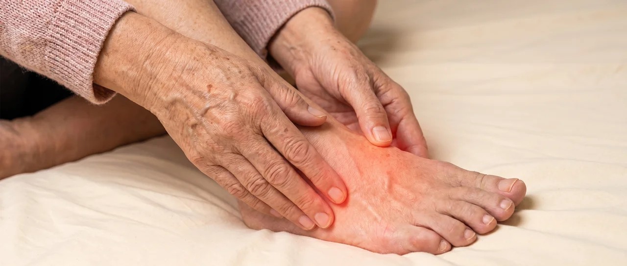Hands holding a foot with the painful area highlighted — neuropathy