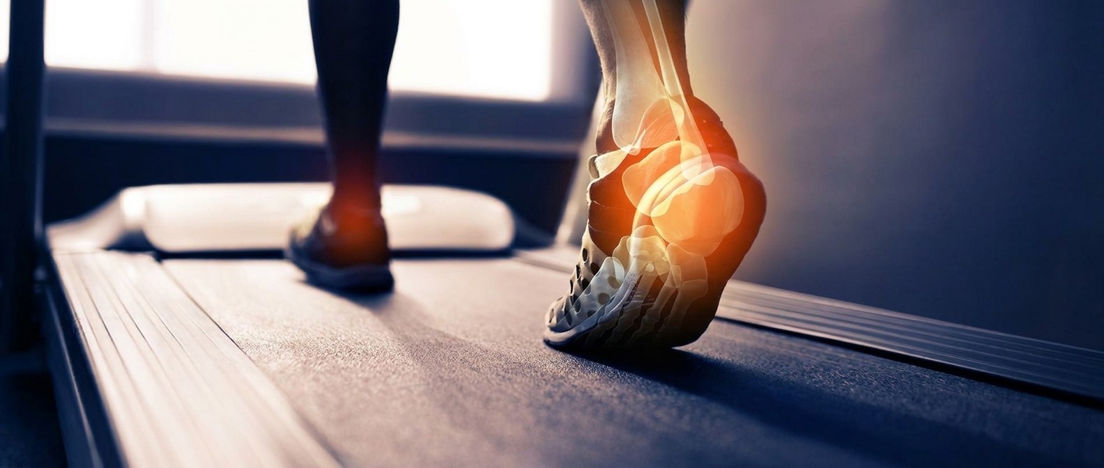 Runner's heel on a treadmill with X-ray overlay and red pain highlight
